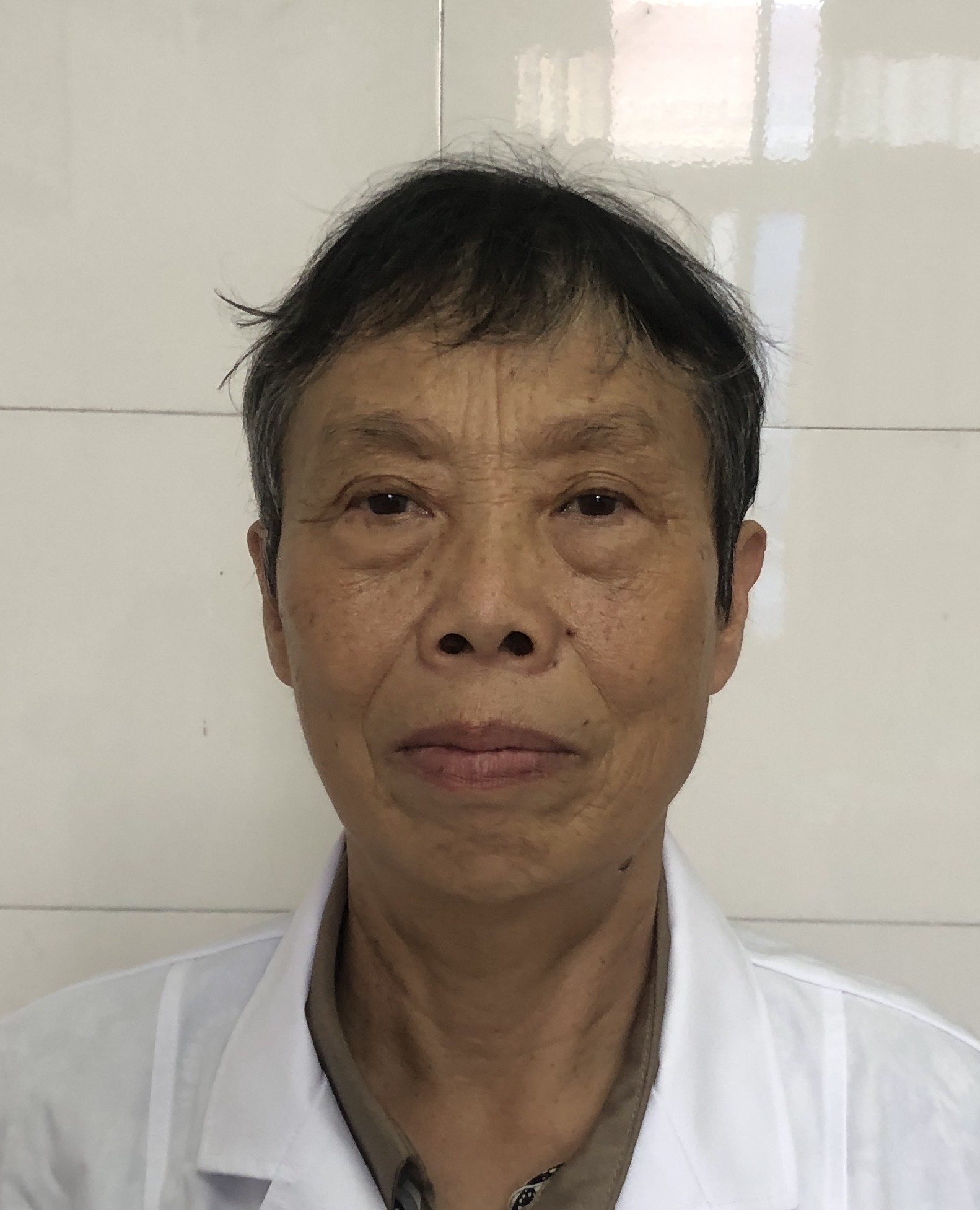 李望星医生