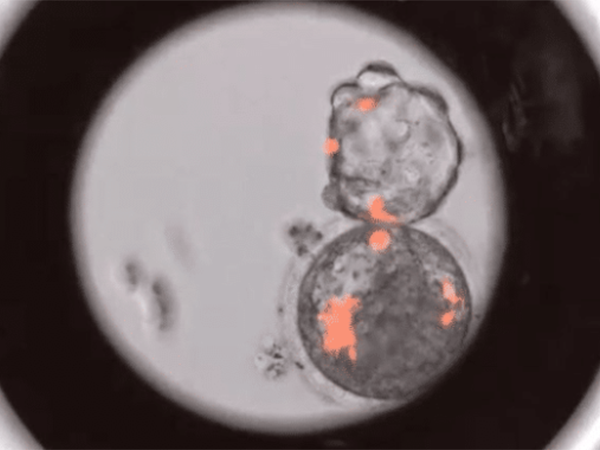 5bc