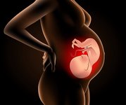 三代试管婴儿PGT适用于高龄反复种植失败多次的人群吗？