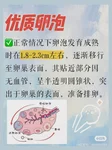 赵捷 (北京大学第三医院) 擅长胚胎培养相关诊疗吗？
