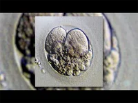 移植后焦虑崩溃？试试深呼吸4秒吸气法